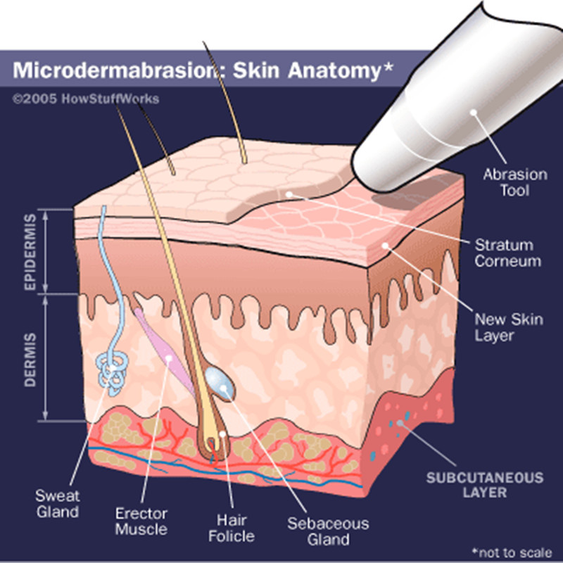 Venta directa de Microdermabrasión de la venta de la máquina de la belleza de la peladura del diamante de la venta caliente