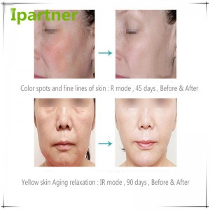 Equipo caliente de la belleza de la terapia del fotón de la venta LED para el cuidado de piel