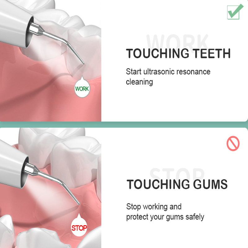 Visualización de uso Home Visualización ultrasónica Cálculo dental limpiador, cámara de alta definición incorporada y luz LED con 3 modos de dientes de limpieza