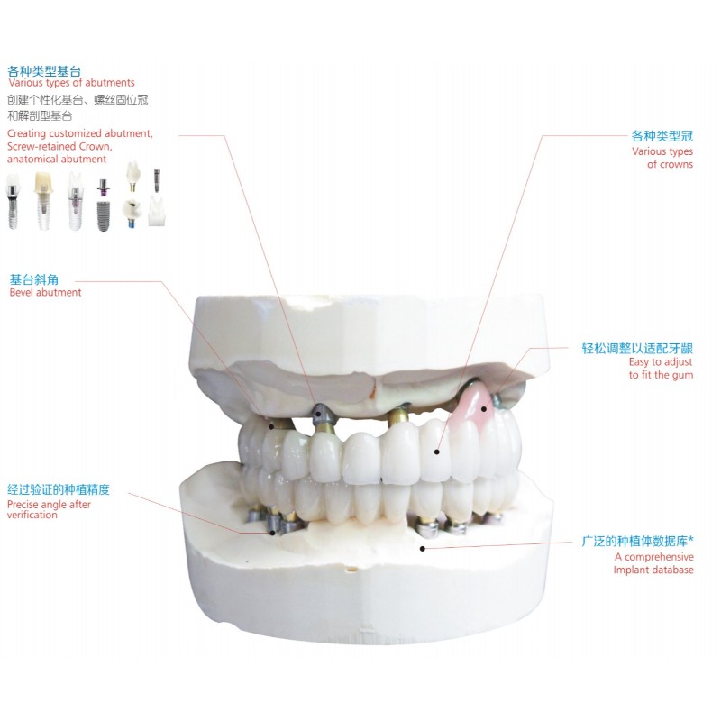 implante dental