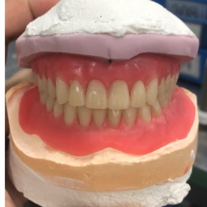 Serie de dentaduras acrílicas